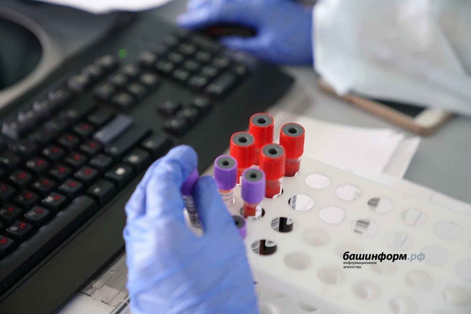 В Башкирии три человека заразились бешенством